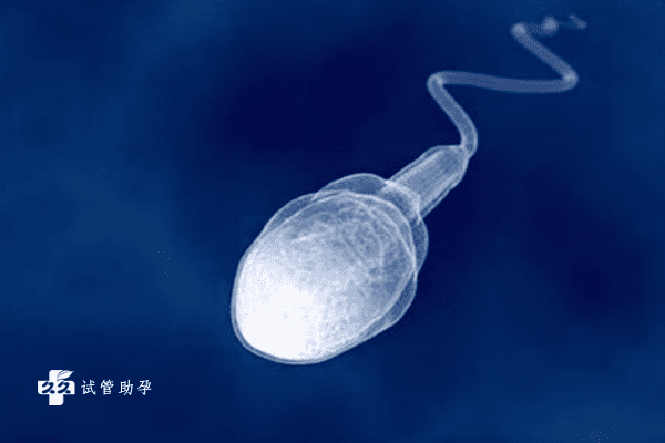 男性输精管堵塞应该如何治疗？