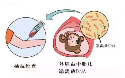 做无创不用强调试管婴儿