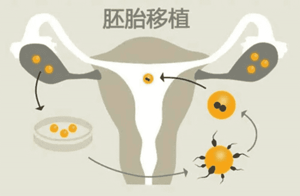 试管婴儿的具体步骤及时间，把握好每一步