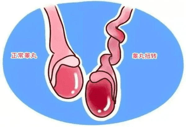 附睾穿刺危害解读，没有你想象中那么可怕