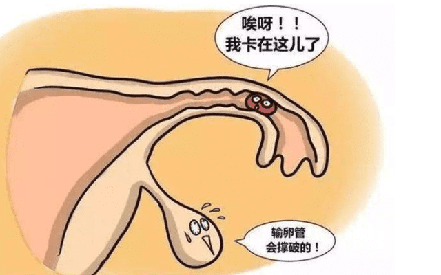 宫颈炎怎么治疗才能好？可以治好吗？