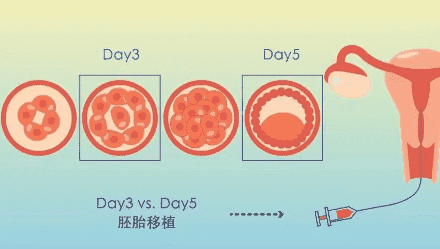 子宫内膜增厚刮宫疼吗?刮宫手术是什么感觉?