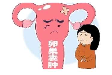 卵巢囊肿会引起月经：卵巢囊肿会引起月经量增多吗?