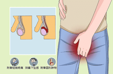 阴囊囊肿能取精吗？阴囊囊肿能做试管婴儿吗？