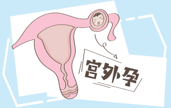 做试管婴儿怎么避开宫外孕?