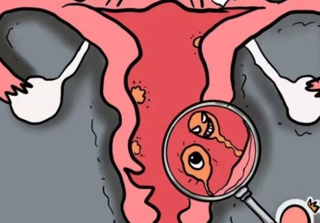 患有宫颈息肉可以做试管婴儿吗？	