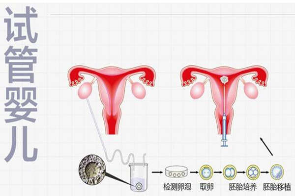 试管婴儿第一次成功的几率大吗？有哪些影响因素？