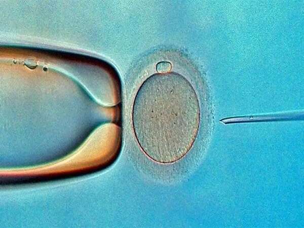 在北京做试管婴儿可以回老家生孩子吗？