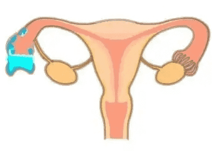 14.png