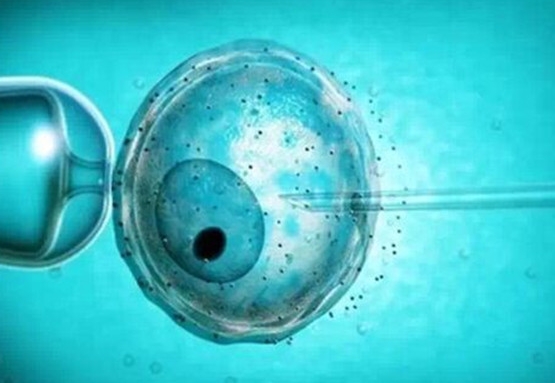 绝经女性能做试管吗？试管婴儿技术可以帮助绝经人群怀孕	
