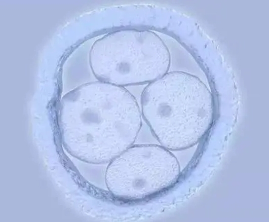 试管复苏移植，费用知多少？