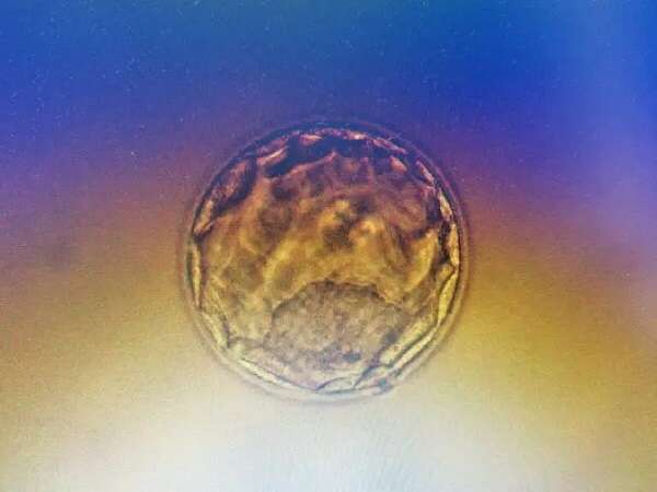 三代试管全程需要几个月？