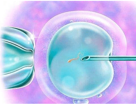 单角子宫做试管成功率高吗？单角子宫怀孕期间的注意事项