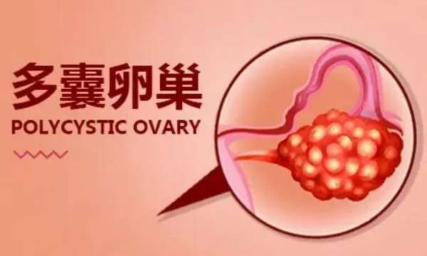 子宫息肉去上海中山医院做试管要花费多少钱？费用明细是怎么样的