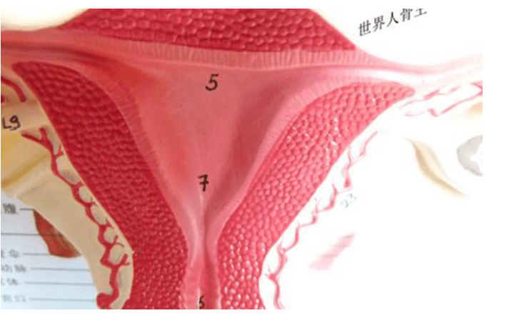 子宫息肉可以去泰国BNH医院做试管婴儿吗？需要花费多少钱