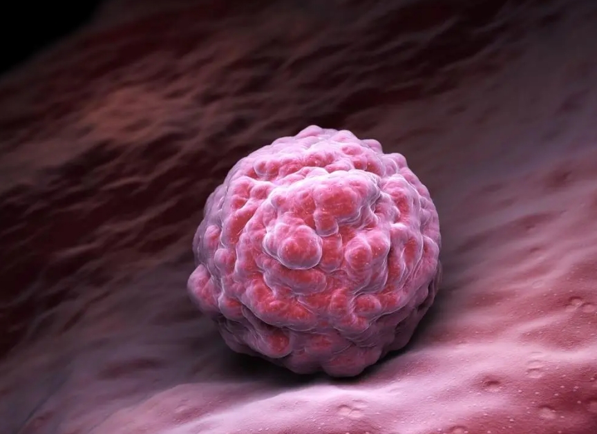 2025年hiv患者可以去马来西亚做试管吗？大概需要花费多少钱