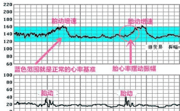 2025年怀蛇宝去厦门做三代试管麻烦吗？需要花费多少钱