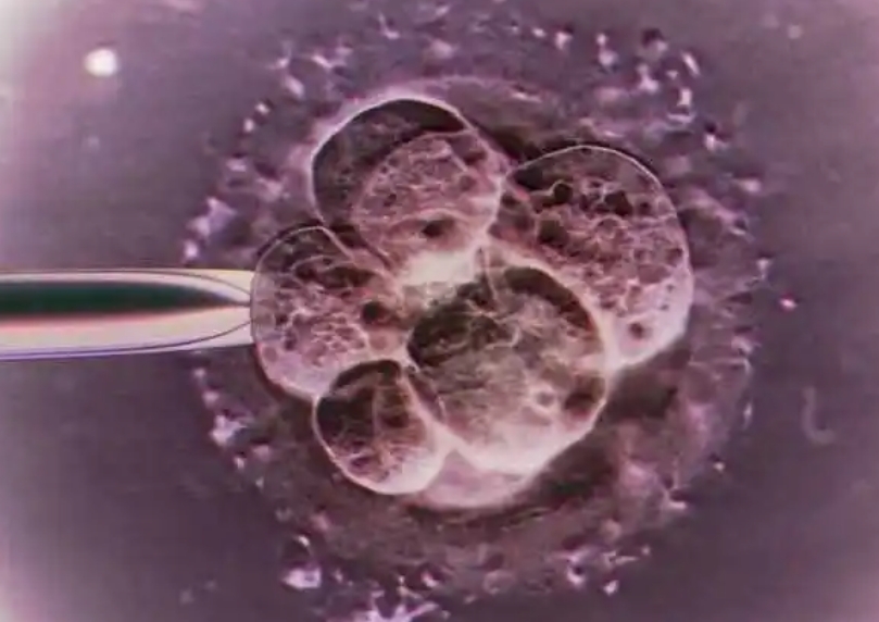 2025年hiv患者去泰国做三代试管麻烦吗？需要花费多少钱