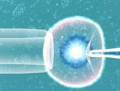 2025年怀蛇宝去北京做三代试管麻烦吗？需要花费多少钱