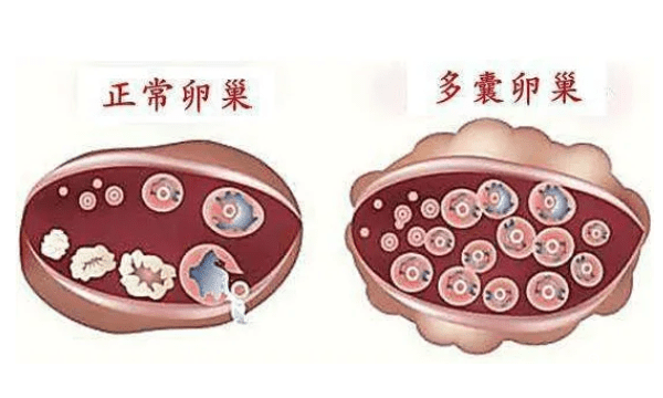 @达州本地人，试管医院名单总结，哪种技术好看就知道了