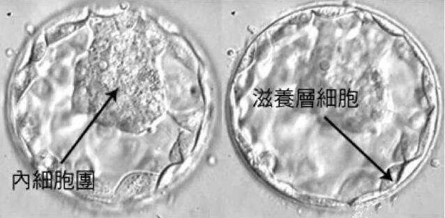 深圳试管婴儿费用多少钱？