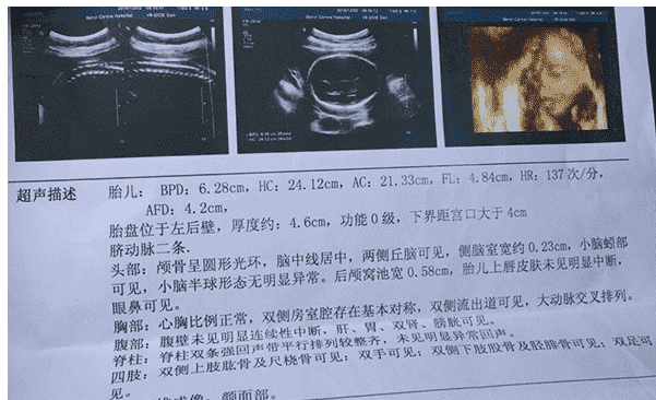 珠海妇幼试管婴儿总花费（珠海试管婴儿大概多少钱）
