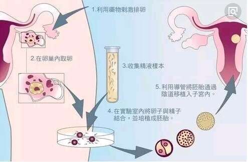 泰国三代试管婴儿费用全解析，高性价比的生育之旅