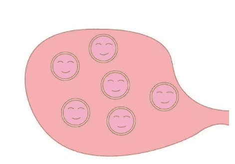 不排卵的女性能做试管婴儿吗？谁适合试管婴儿？