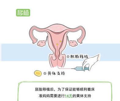 泰国高龄单身试管成功率高吗？