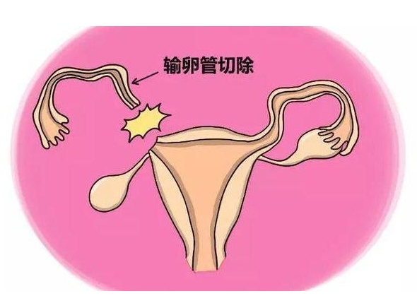 天津市哪家试管婴儿医院排名比较好？权威推荐