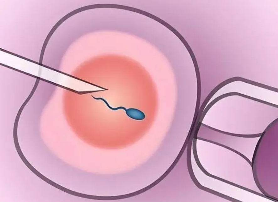 试管婴儿总共多少钱？试管婴儿费用一览