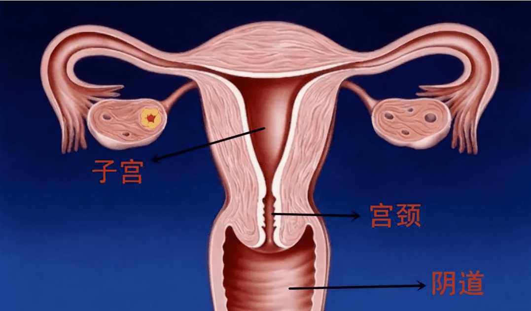 子宫腺肌症能做试管吗？做试管有影响吗？