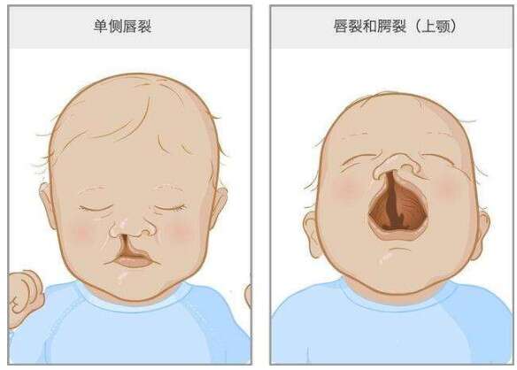 去泰国做试管婴儿要多少钱？