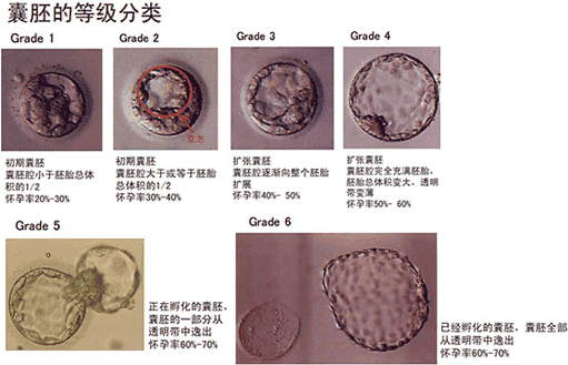 卵巢早衰试管婴儿成功率多少