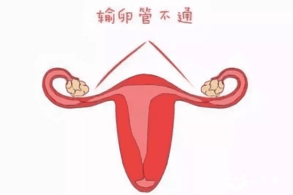 艾滋病患者洗精术后再做试管婴儿生育靠谱吗