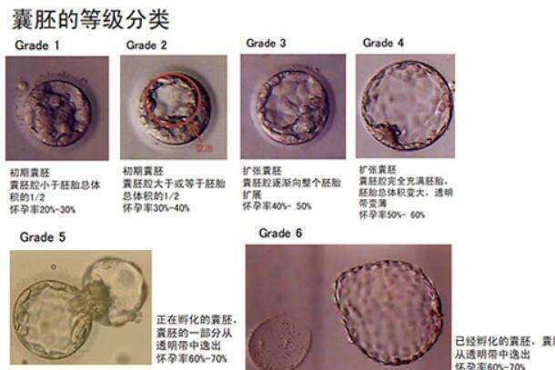 泰国第三代试管婴儿费用大约多少？