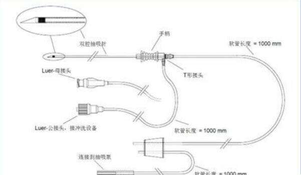 宫腔粘连可以考虑做试管吗？宫腔粘连试管促排方案及流程解读