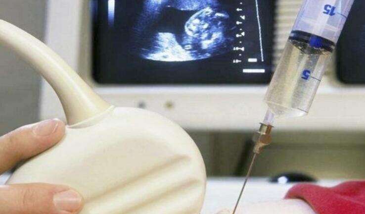 详谈女性不孕不育的检查方法