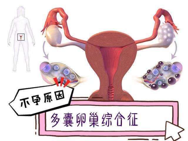 泰国第三代试管婴儿费用怎么收？你看了全都懂