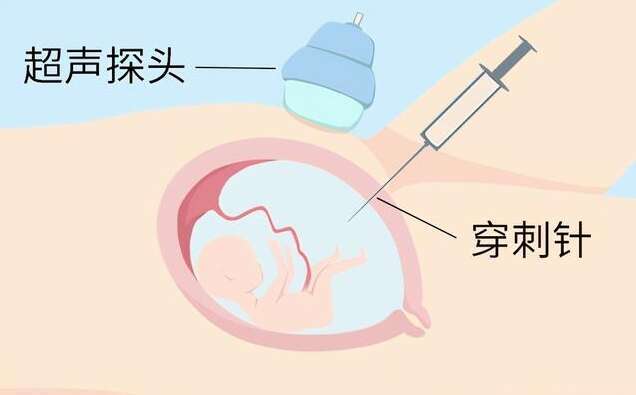 单侧输卵管能促排卵吗？单侧输卵管可以促排吗？