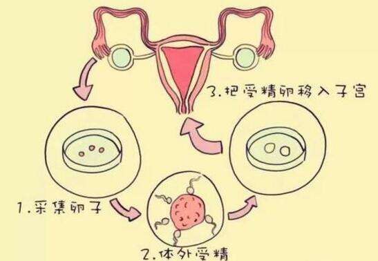 浙江地区有哪些私立的机构可以做试管技术？女性做B超憋尿方法是什么呢？