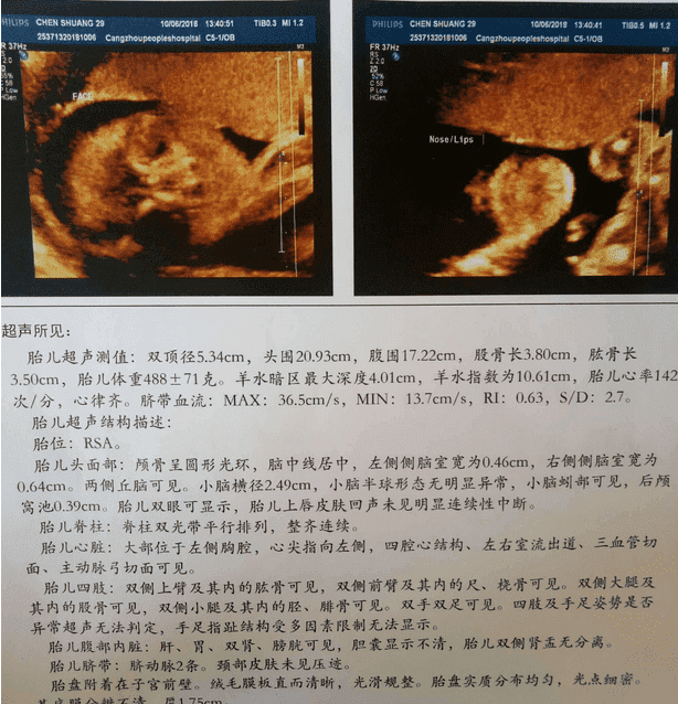 太原地区有哪些私立的机构可以做试管技术？验孕棒刚开始一深一浅怎么回事？