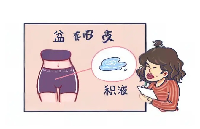 试管婴儿促排卵期间应该注意哪些问题呢？