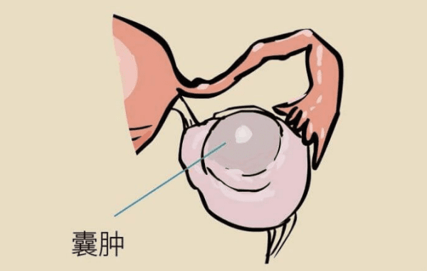 类风湿关节炎可以正常生小孩吗