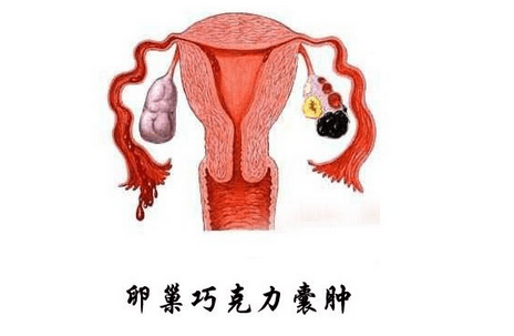 子宫寒冷能做试管婴儿吗？