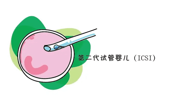泰国三代试管技术介绍？热门”泰国试管有啥优势？