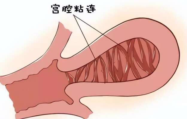 揭秘泰国三代试管婴儿，技术领先，性价比之选，圆梦海外育儿新途径