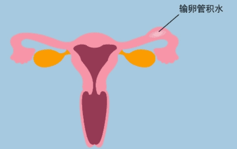 马来西亚试管婴儿概括？