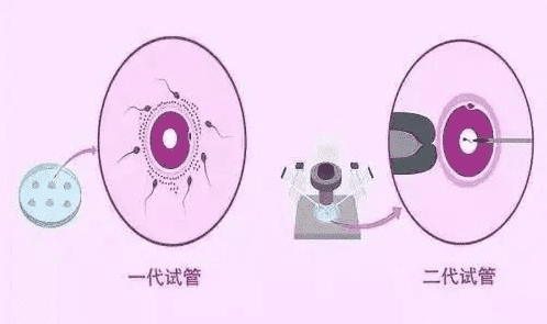 做试管婴儿胚胎移植前后的饮食及注意事项