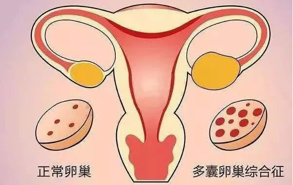 俄罗斯单身试管机构试管费用一览
